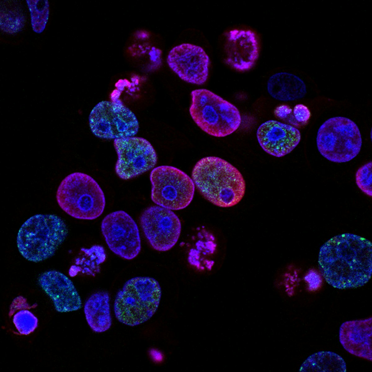 Fluorescence microscopy of cells
